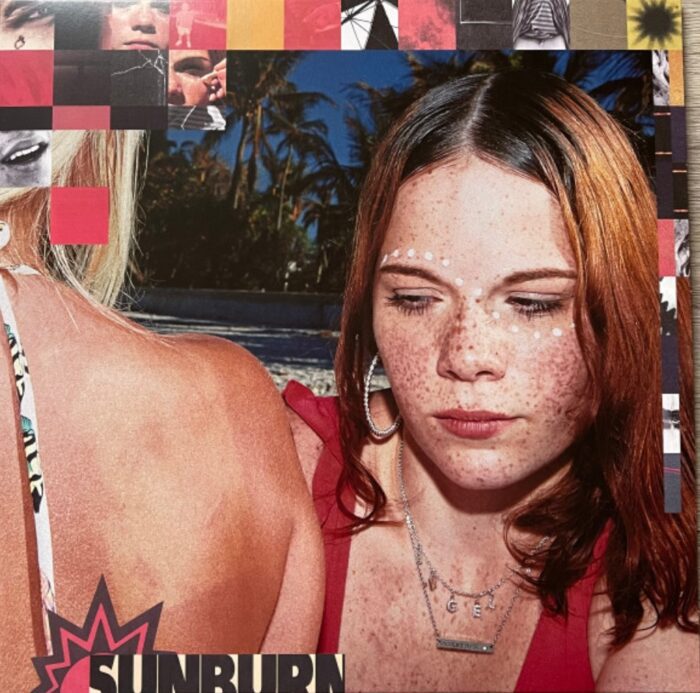 Fike, Dominic – Sunburn